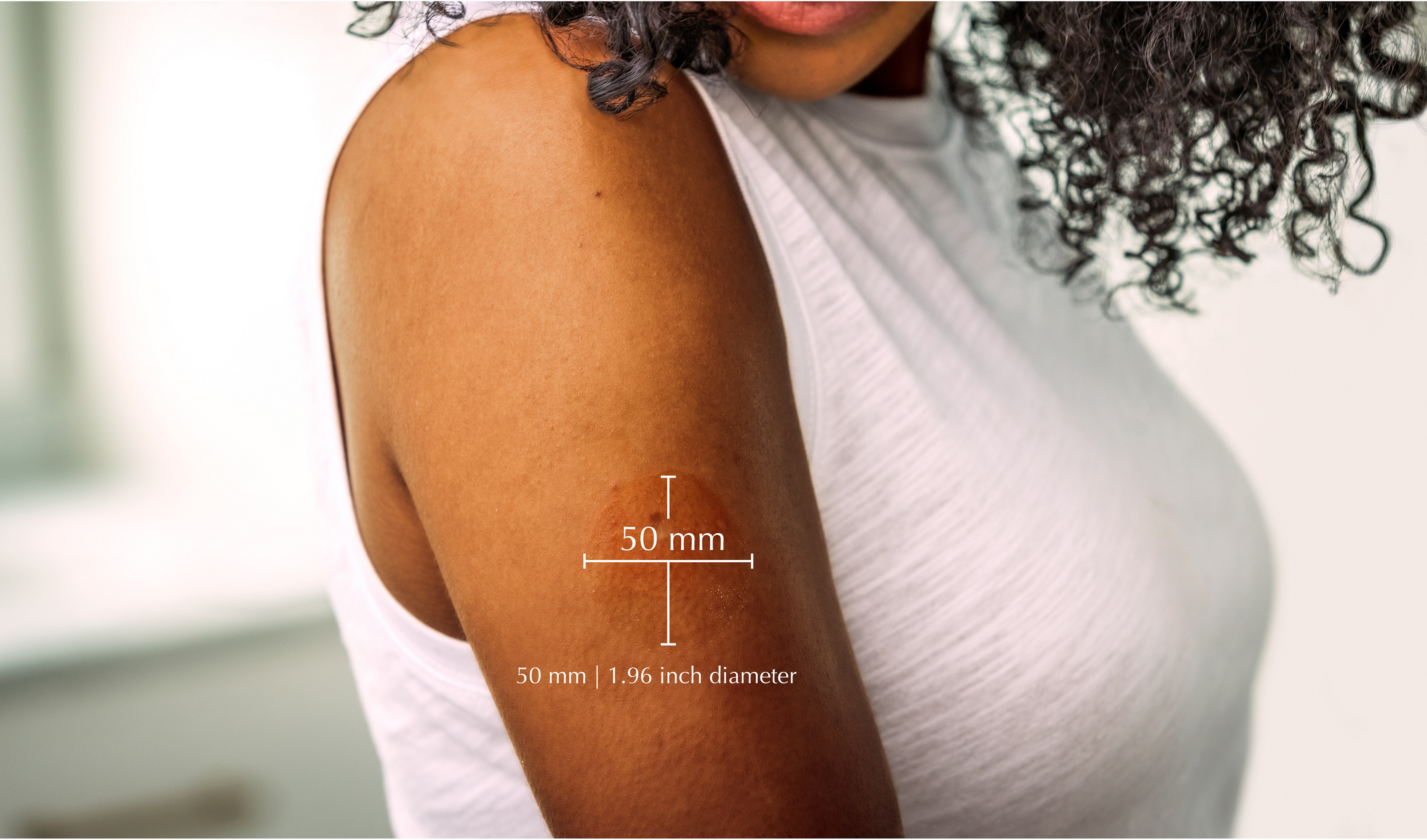 re/cover™ Eczema Relief System