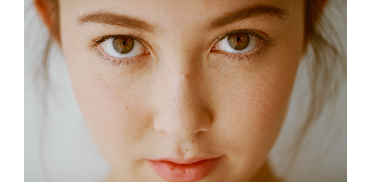 Acne-Prone Skin: Treatment and Skin Care