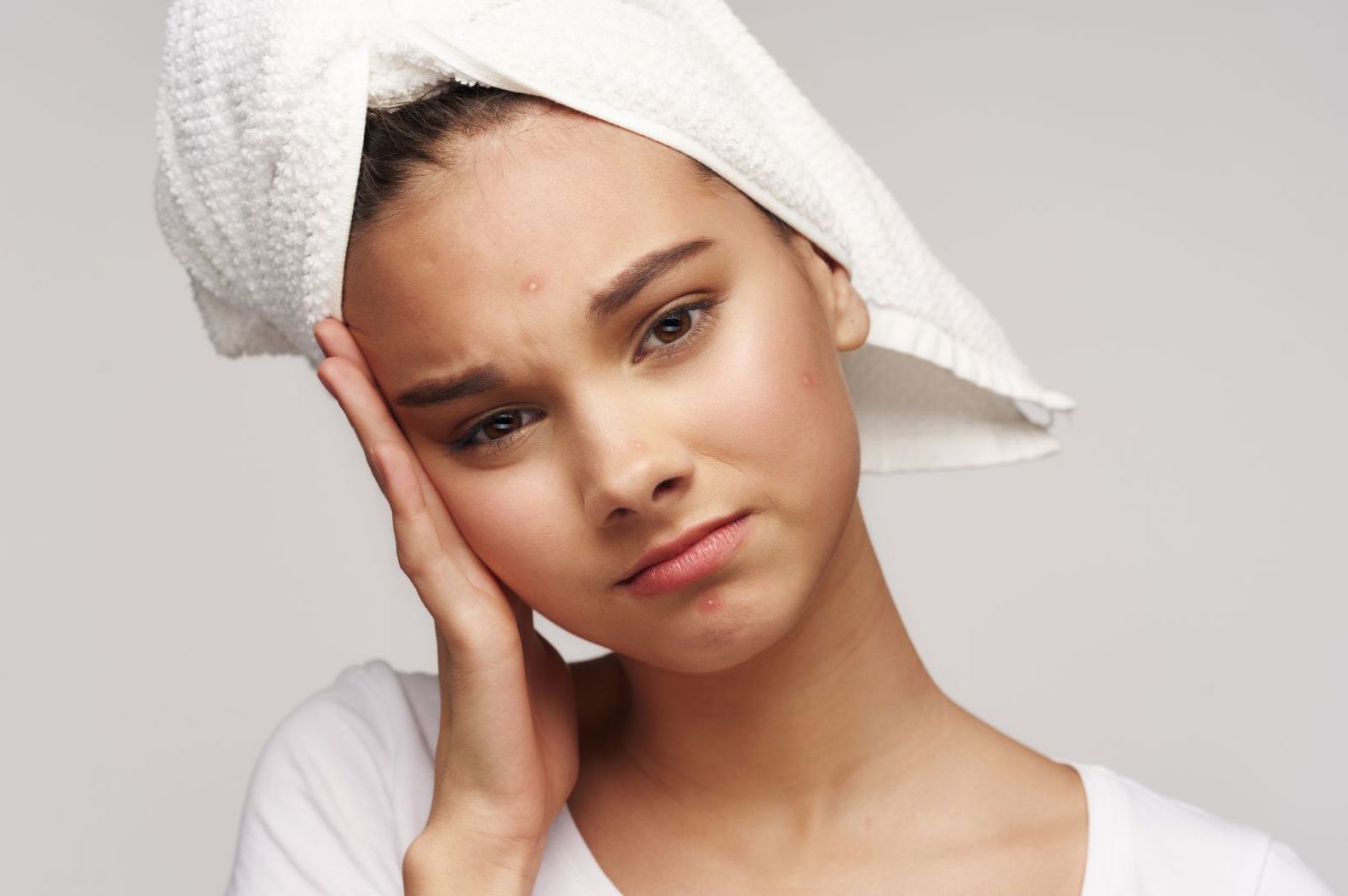 How To Get Rid of Pimples on Forehead Effectively