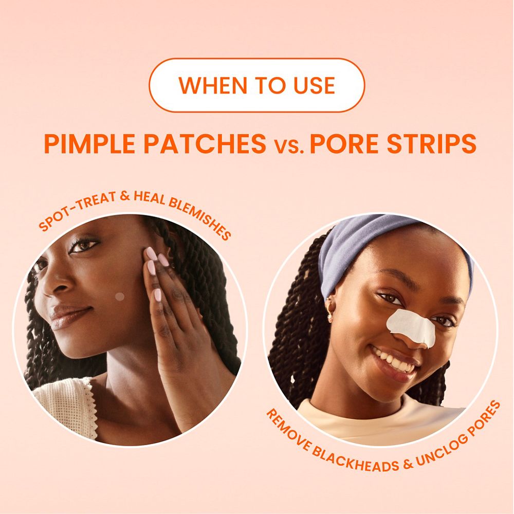 when to use pimple patches vs. pore strips. use pimple patches to spot-treat and heal blemishes, and use pore strips to remove blackheads and unclog pores