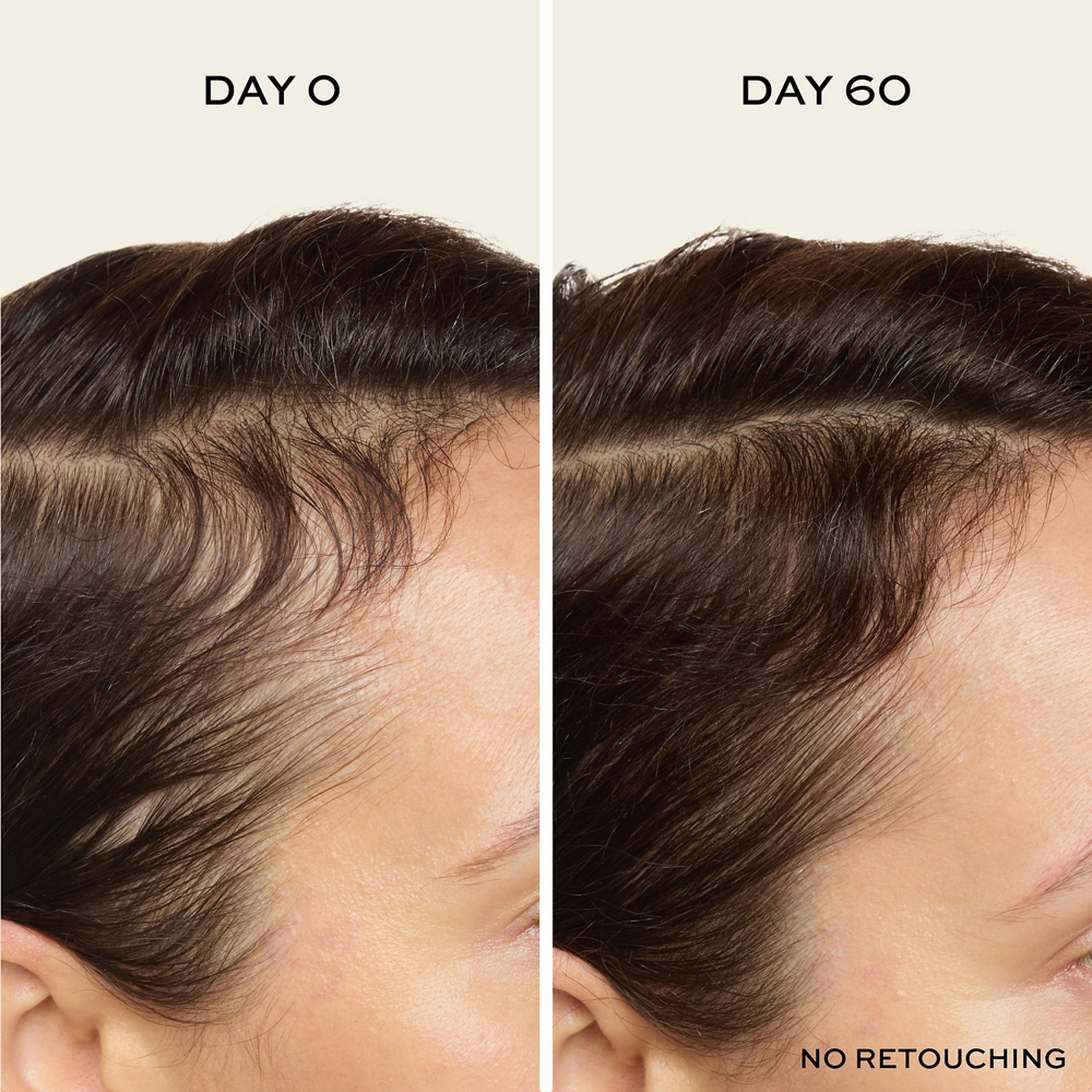 Before/After 60 Days with the John Frieda ULTRAfiller+ Hair Density Scalp Serum