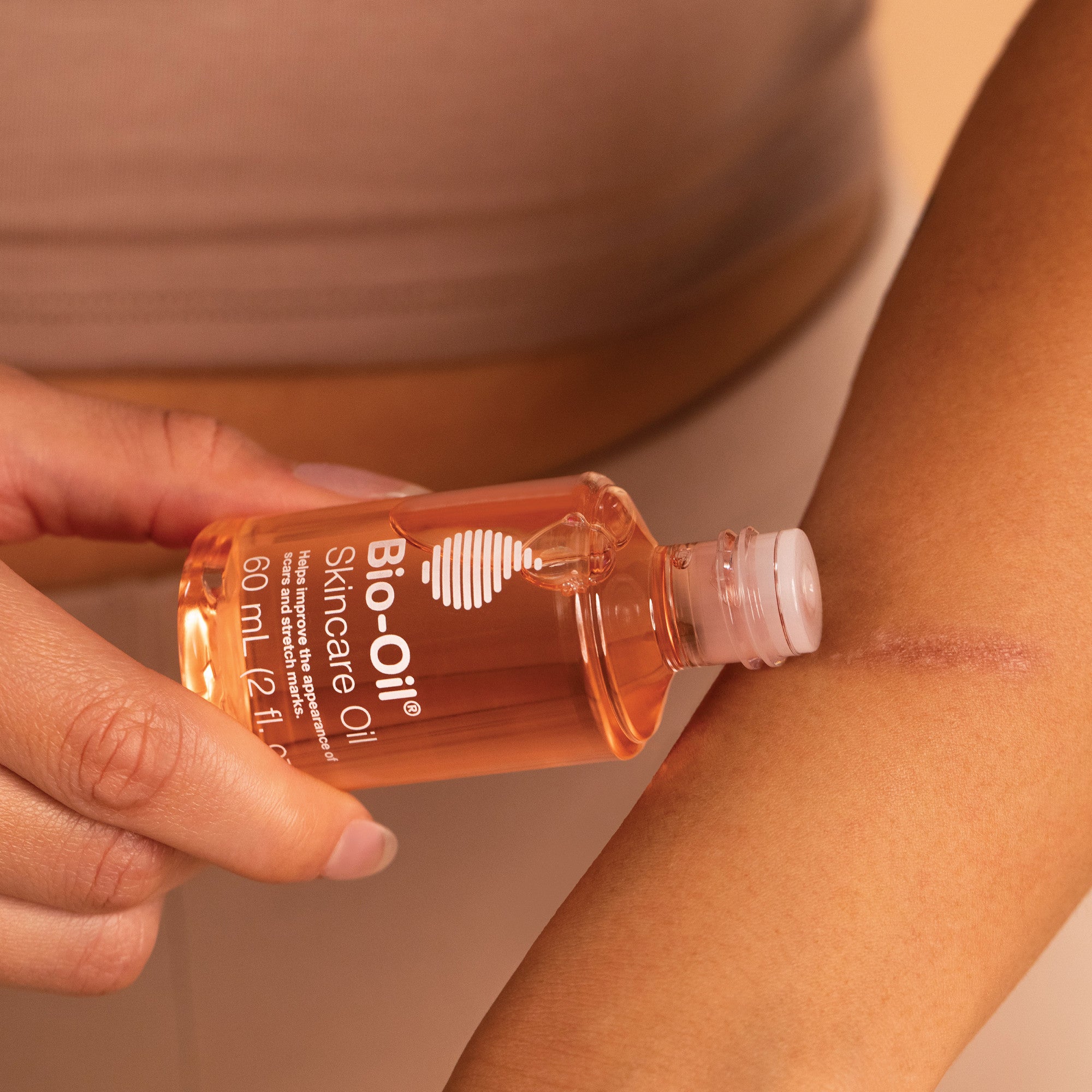 A woman is holding a bottle of Bio-Oil Skincare Oil on her arm.