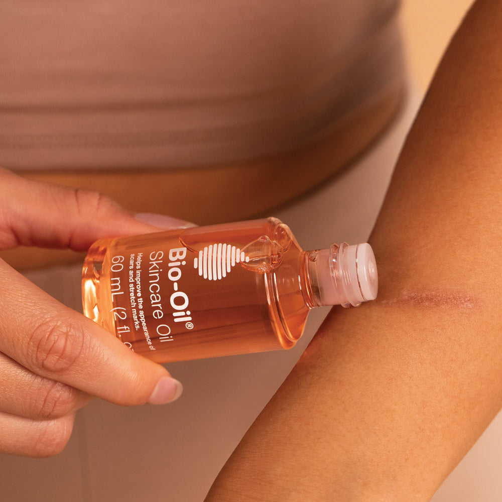 A woman is holding a bottle of Bio-Oil Original 3 Month Bundle on her arm.