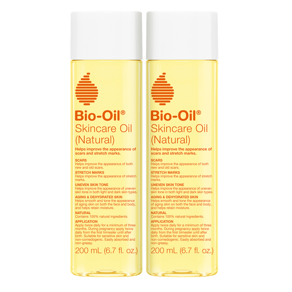 Bio Oil Before & After 4 Years Later 