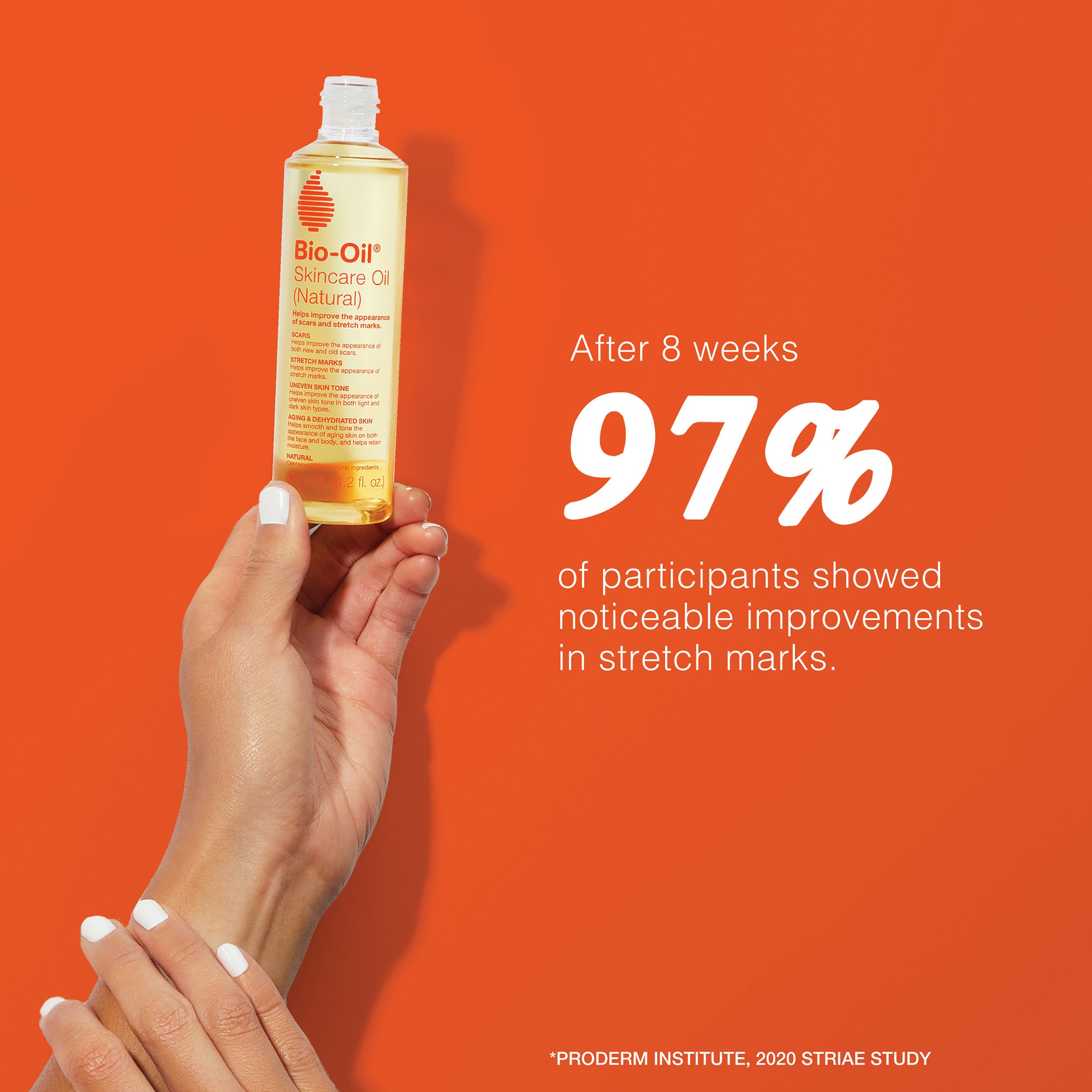After 8 weeks 97% of participants showed noticeable improvements in stretchmarks. *Proderm institute, 2020 STRIAE study